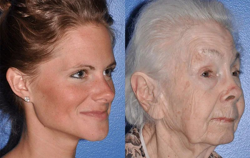 Understanding The Aging Face Seattle Face And Skin